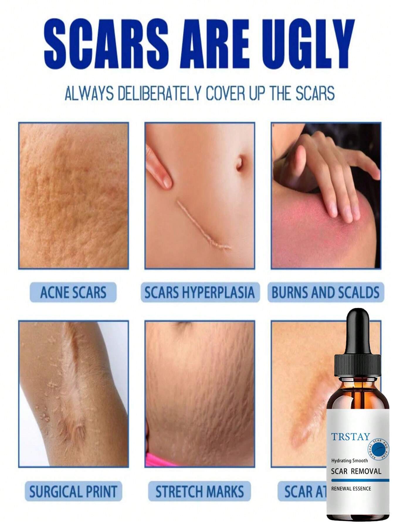 Scar Removal Moisturizer for Smooth Skin - Image 2