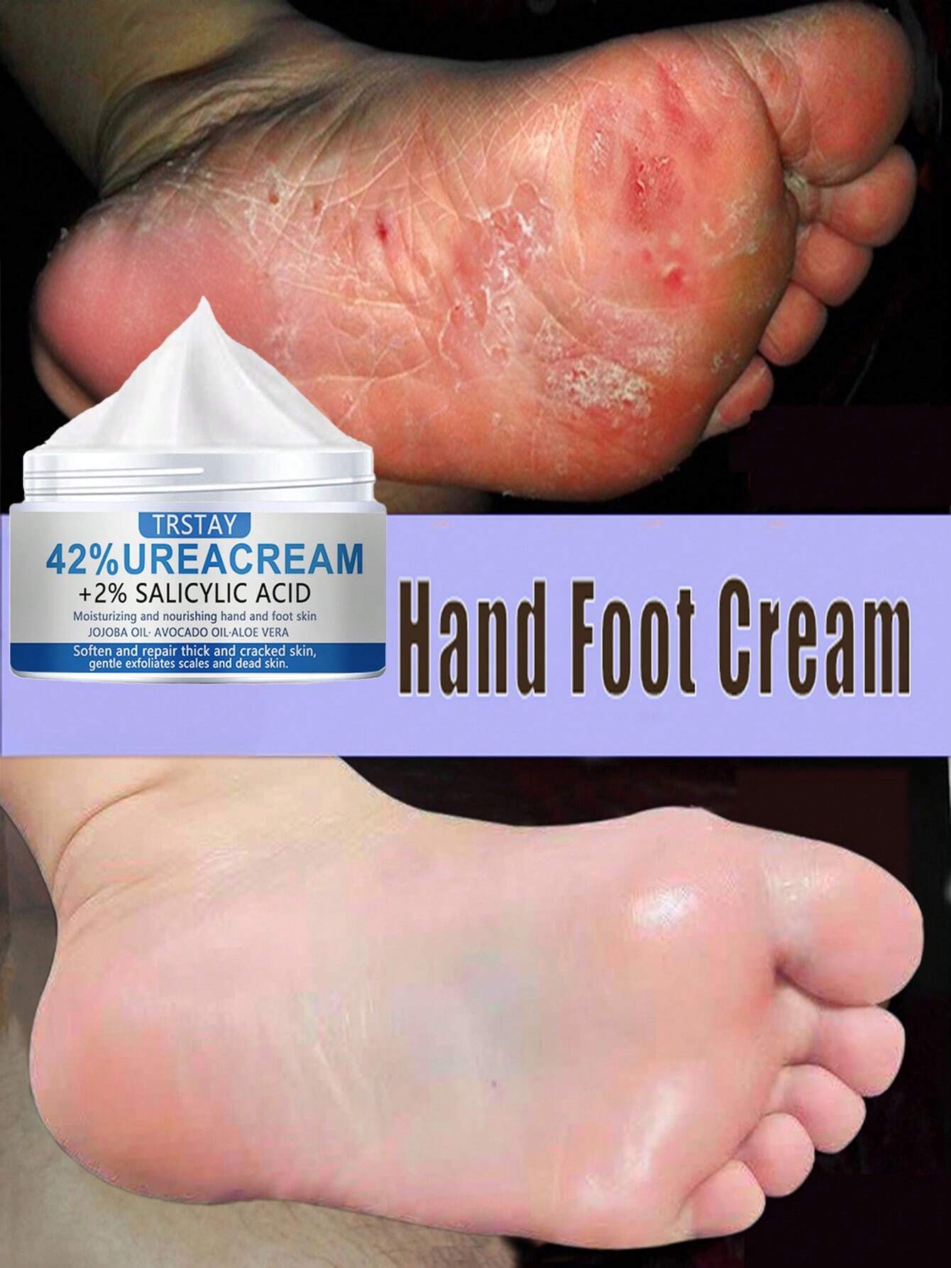 Moisturizing cream for dry skin, foot care, hand and foot repair cream - Image 3