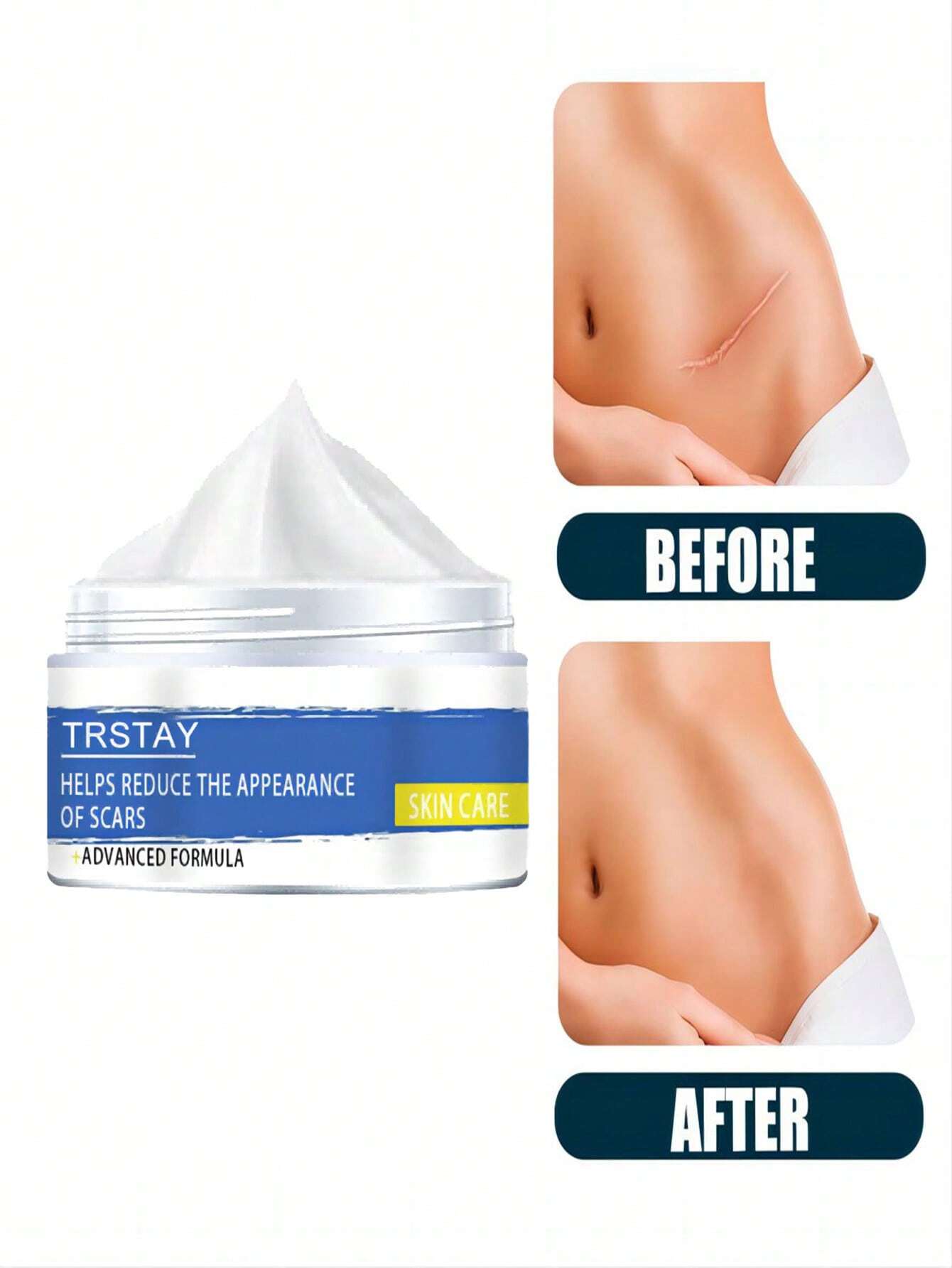 Skin Care Cream for Scars, Stretch Marks and Acne Skin, Scar Repair Cream for Scar Lightening and Skin Care Products for Skin Refreshment - Image 2