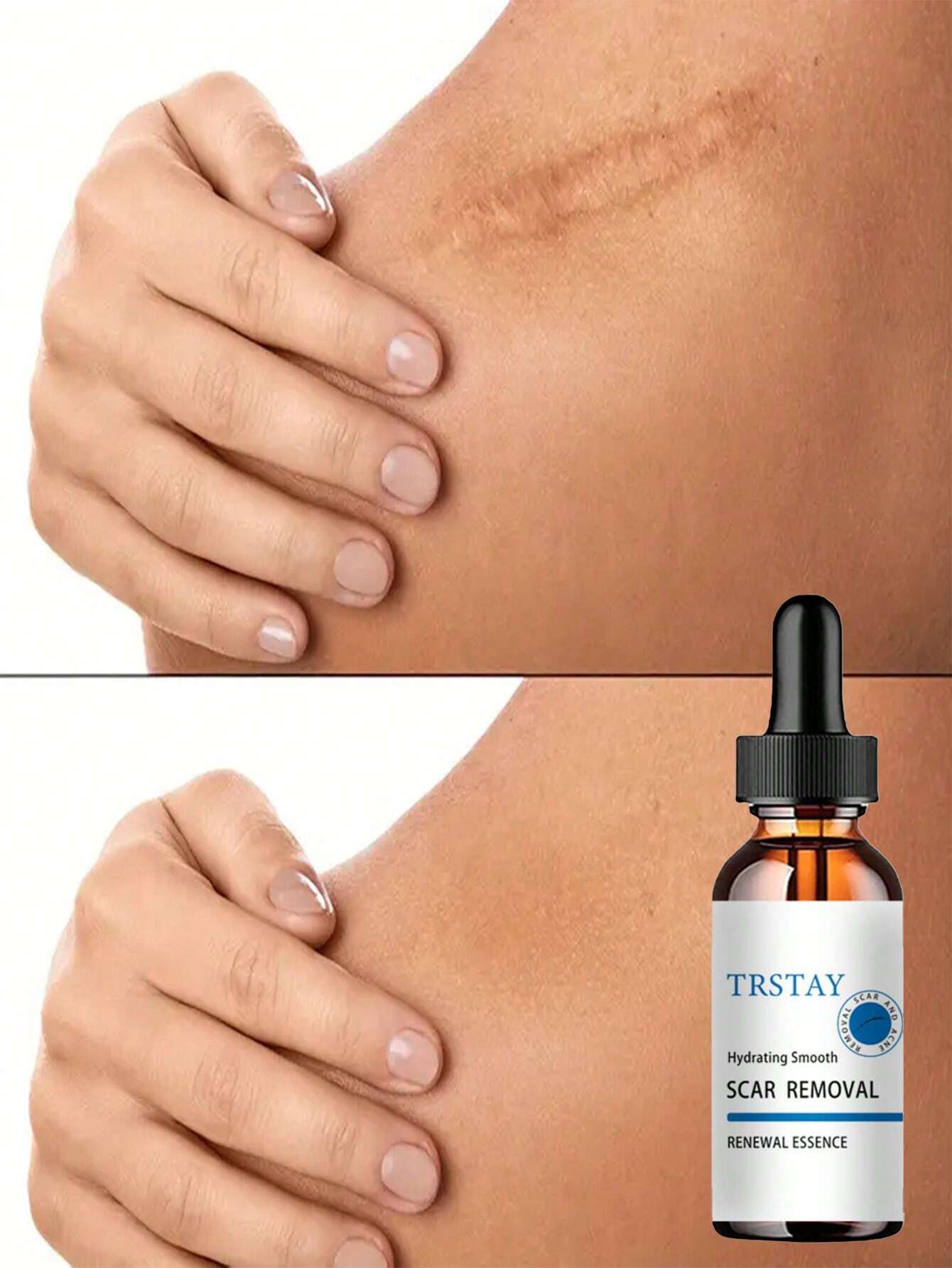 Scar Removal Moisturizer for Smooth Skin - Image 3