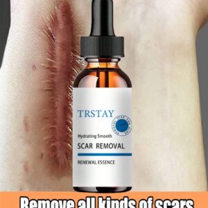 Scar Removal Moisturizer for Smooth Skin
