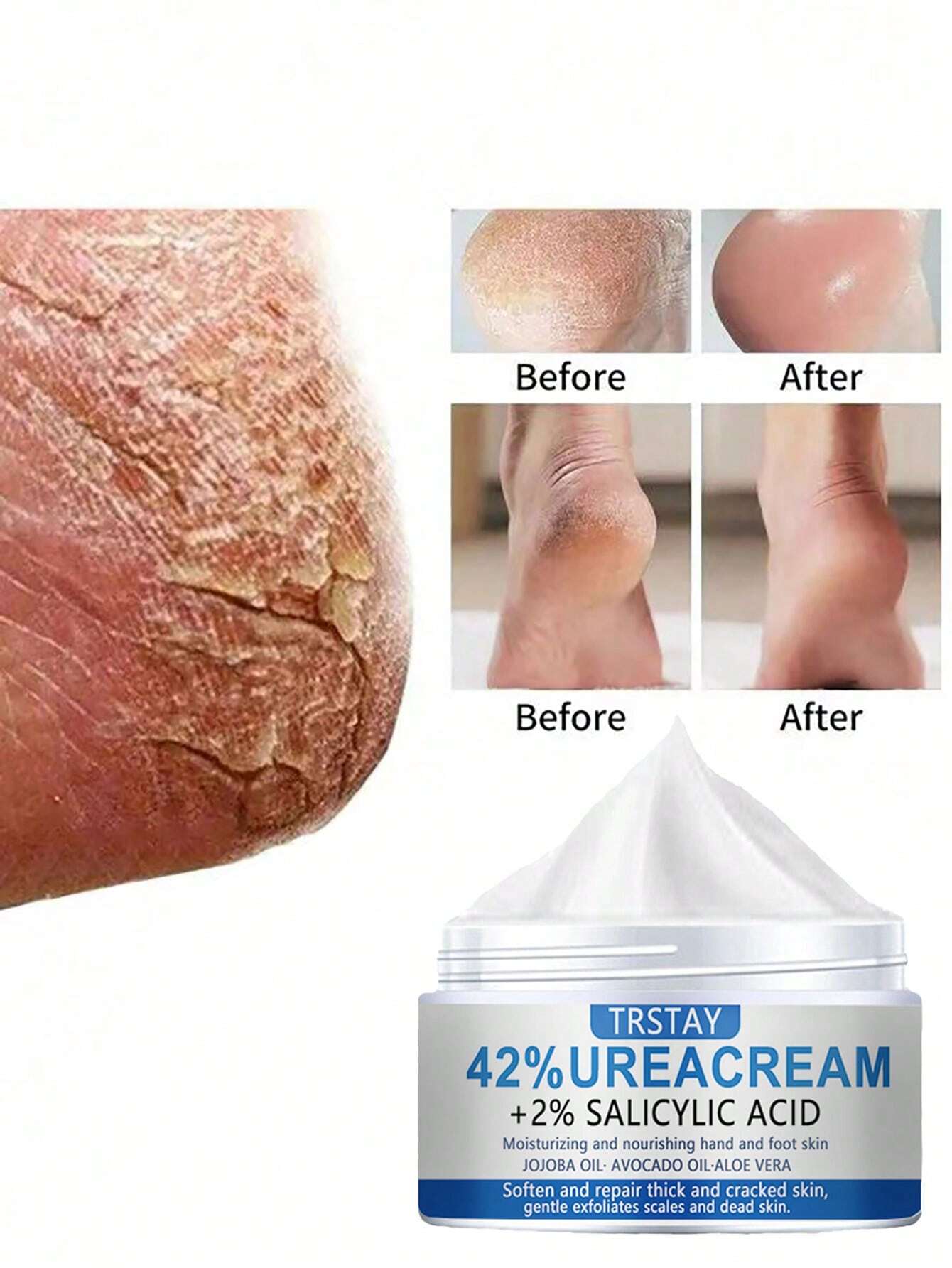 Moisturizing cream for dry skin, foot care, hand and foot repair cream - Image 2